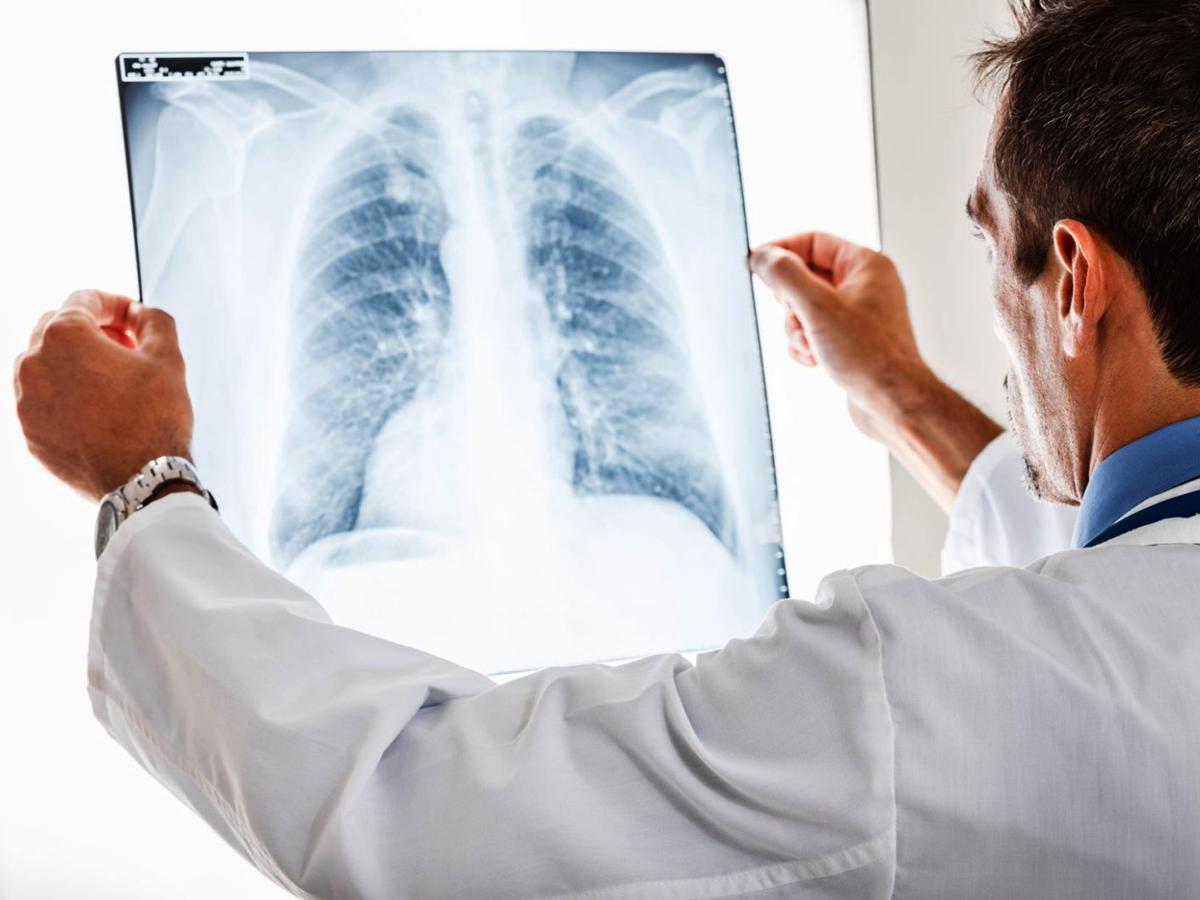 Equipo de radiografía en Altacura Concepción