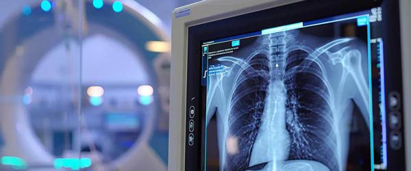 Radiación en rayos X: ¿es segura?