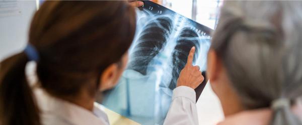 Radiografía, ecografía o TAC: ¿cuál necesito?